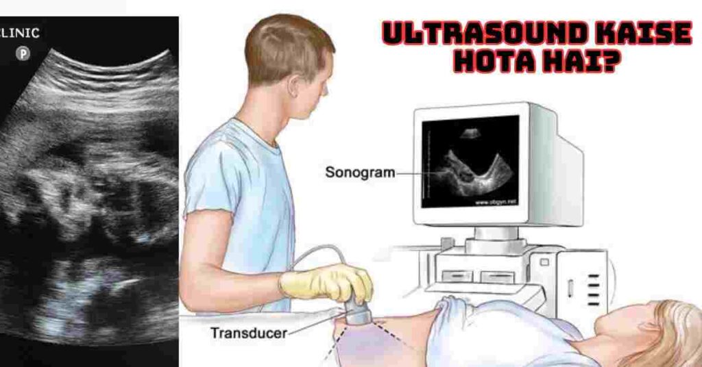 Ultrasound Kya Hai | Ultrasound Kaise Hota Hai?